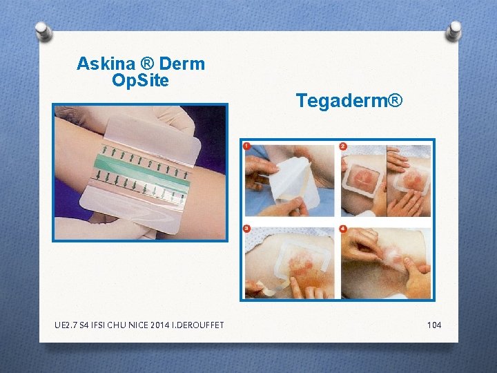 Askina ® Derm Op. Site UE 2. 7 S 4 IFSI CHU NICE 2014 Askina ® Derm Op. Site UE 2. 7 S 4 IFSI CHU NICE 2014