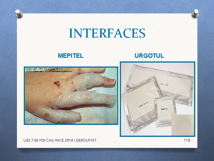INTERFACES MEPITEL UE 2. 7 S 4 IFSI CHU NICE 2014 I. DEROUFFET URGOTUL INTERFACES MEPITEL UE 2. 7 S 4 IFSI CHU NICE 2014 I. DEROUFFET URGOTUL