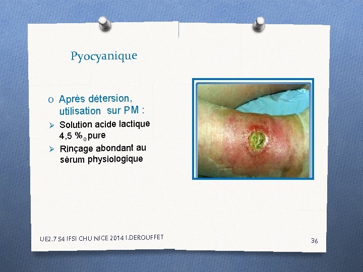 Pyocyanique O Après détersion, utilisation sur PM : Ø Solution acide lactique 4, 5 Pyocyanique O Après détersion, utilisation sur PM : Ø Solution acide lactique 4, 5