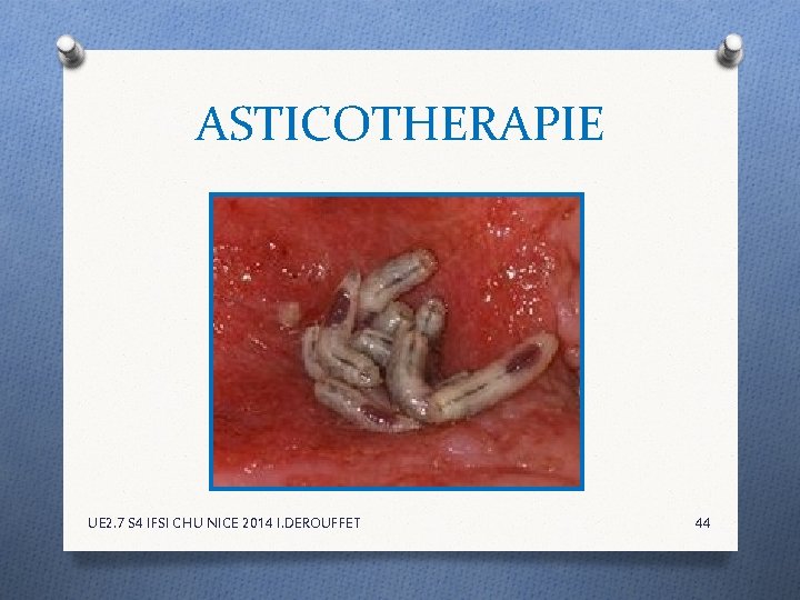 ASTICOTHERAPIE UE 2. 7 S 4 IFSI CHU NICE 2014 I. DEROUFFET 44 ASTICOTHERAPIE UE 2. 7 S 4 IFSI CHU NICE 2014 I. DEROUFFET 44