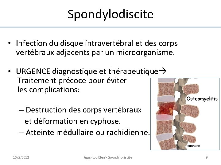 Spondylodiscite • Infection du disque intravertébral et des corps vertébraux adjacents par un microorganisme.