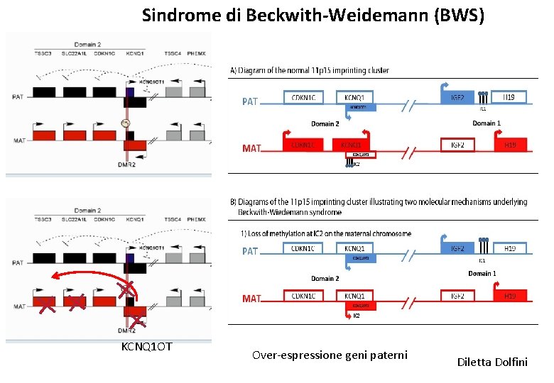 Sindrome di Beckwith-Weidemann (BWS) KCNQ 1 OT Over-espressione geni paterni Diletta Dolfini 