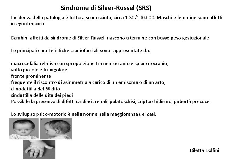 Sindrome di Silver-Russel (SRS) Incidenza della patologia è tuttora sconosciuta, circa 1 -30/100. 000.