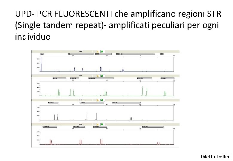 UPD- PCR FLUORESCENTI che amplificano regioni STR (Single tandem repeat)- amplificati peculiari per ogni