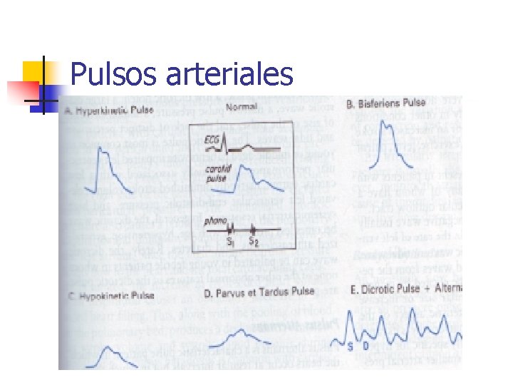 Pulsos arteriales 