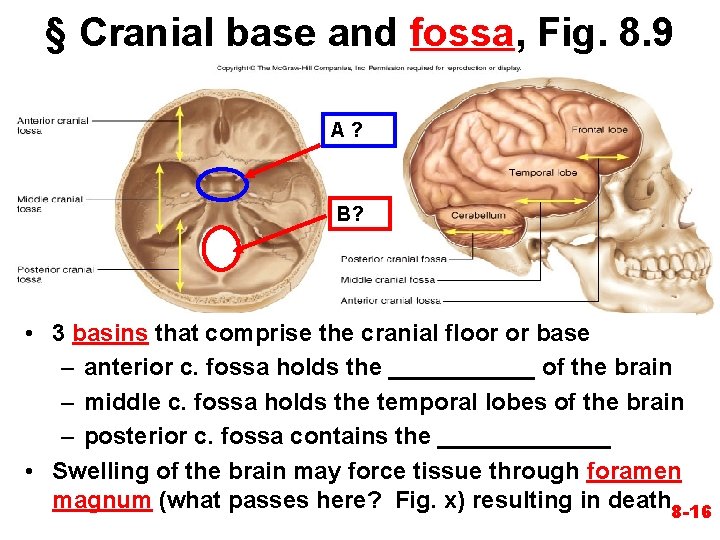 § Cranial base and fossa, Fig. 8. 9 A? B? • 3 basins that § Cranial base and fossa, Fig. 8. 9 A? B? • 3 basins that