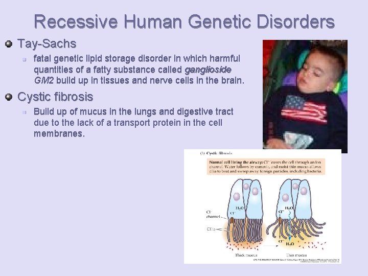 Recessive Human Genetic Disorders Tay-Sachs n fatal genetic lipid storage disorder in which harmful