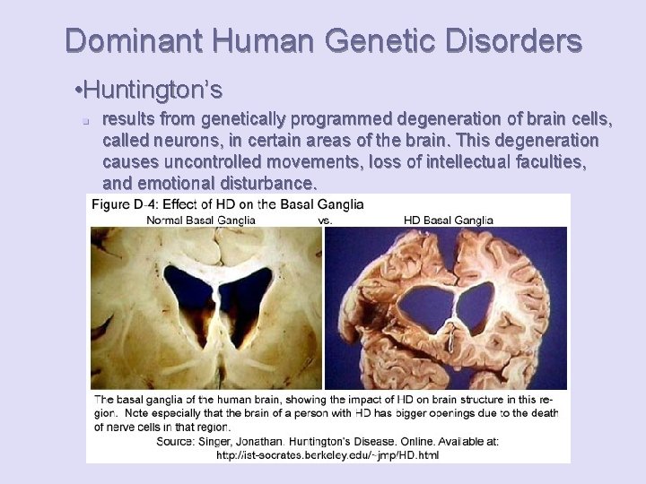 Dominant Human Genetic Disorders • Huntington’s n results from genetically programmed degeneration of brain