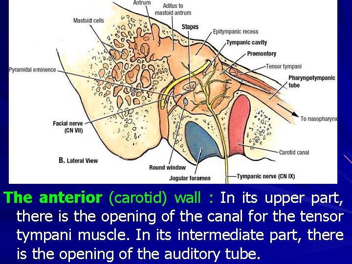 The anterior (carotid) wall : In its upper part, there is the opening of