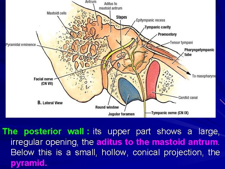The posterior wall : its upper part shows a large, irregular opening, the aditus