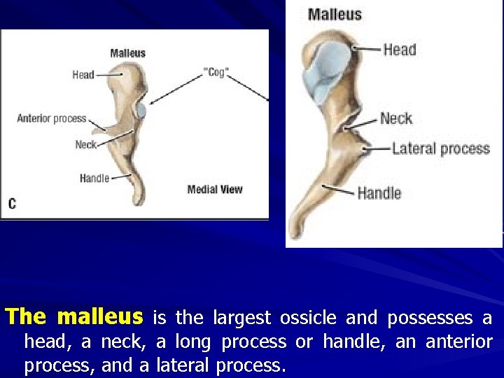 The malleus is the largest ossicle and possesses a head, a neck, a long