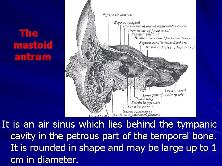 The mastoid antrum It is an air sinus which lies behind the tympanic cavity