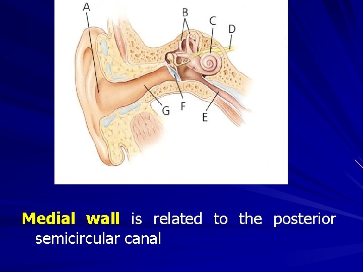 Medial wall is related to the posterior semicircular canal 