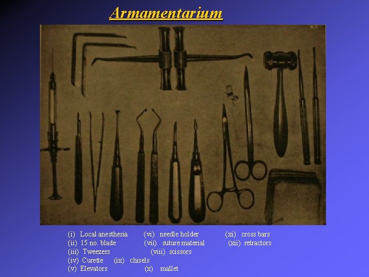 Armamentarium (i) Local anesthesia (vi) needle holder (ii) 15 no. blade (vii) suture material