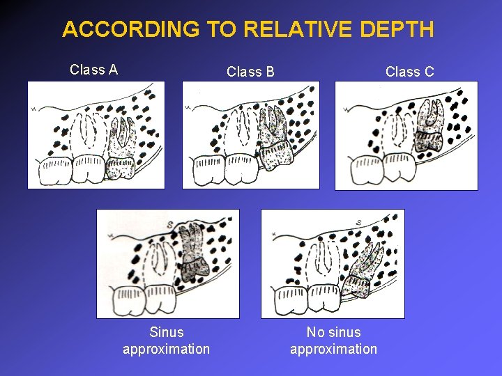 ACCORDING TO RELATIVE DEPTH Class A Class B Sinus approximation Class C No sinus