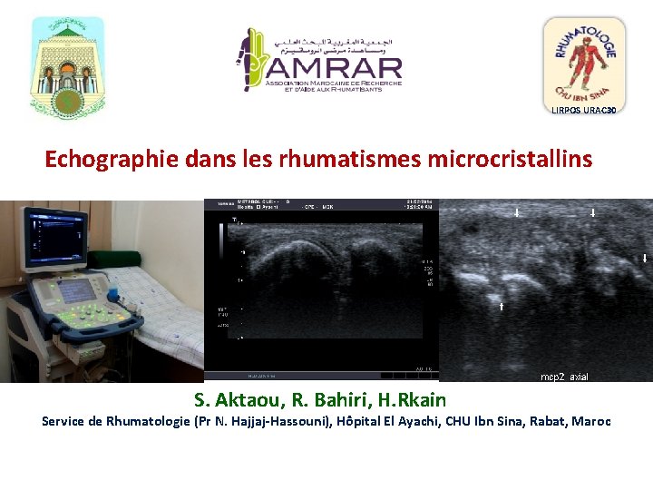 LIRPOS URAC 30 Echographie dans les rhumatismes microcristallins S. Aktaou, R. Bahiri, H. Rkain