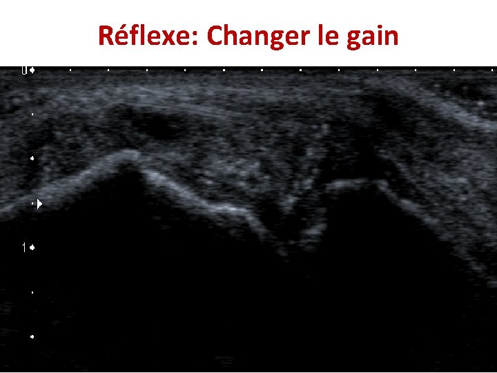 Réflexe: Changer le gain 