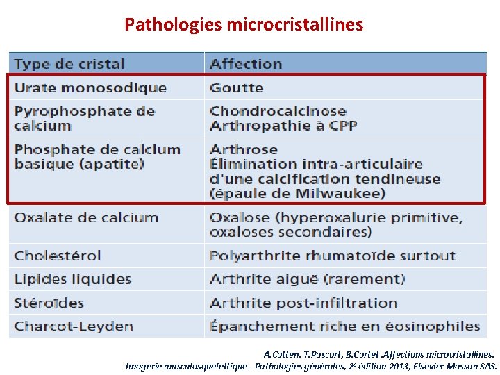 Pathologies microcristallines A. Cotten, T. Pascart, B. Cortet. Affections microcristallines. Imagerie musculosquelettique - Pathologies