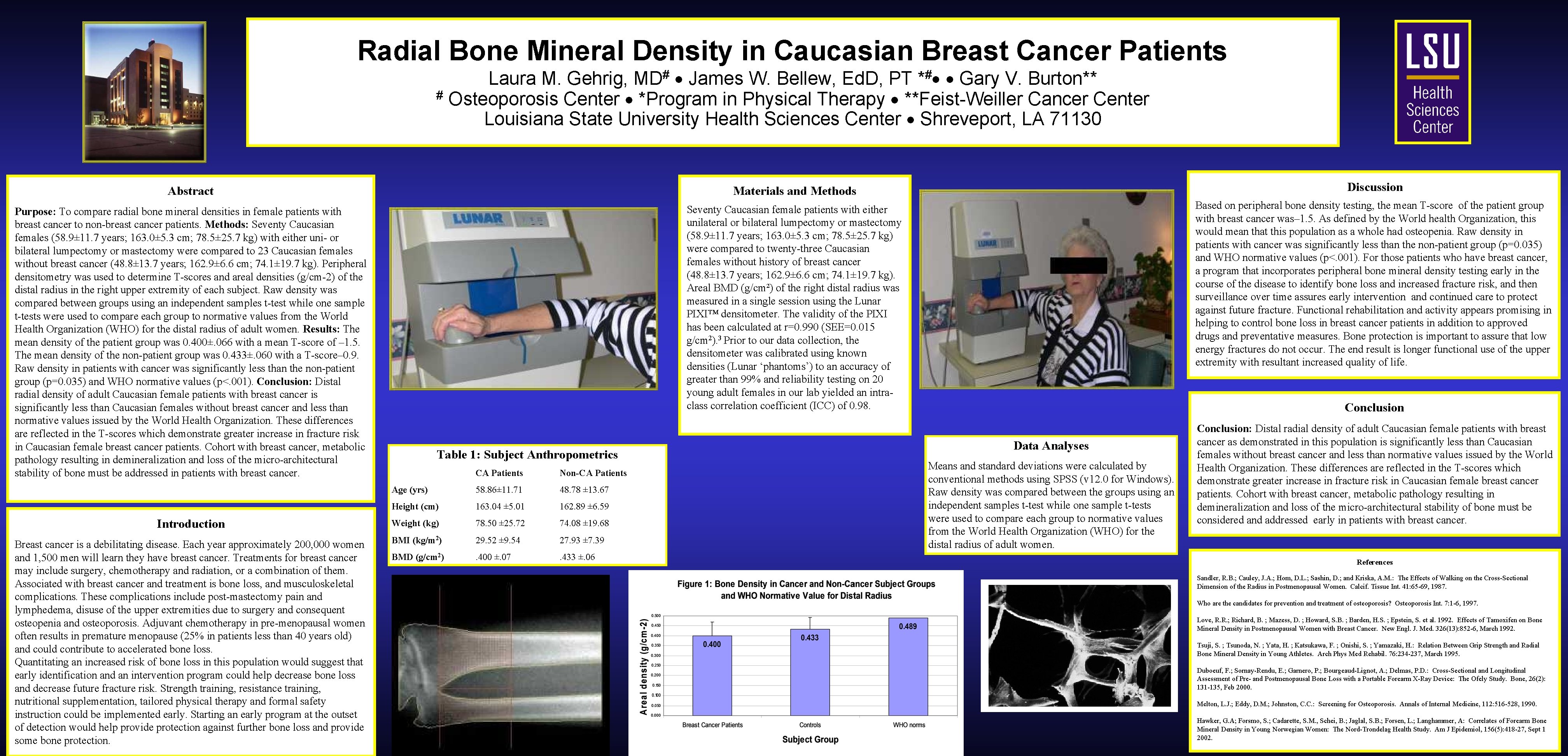 Radial Bone Mineral Density in Caucasian Breast Cancer