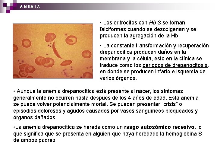 A N EM I A • Los eritrocitos con Hb S se tornan falciformes