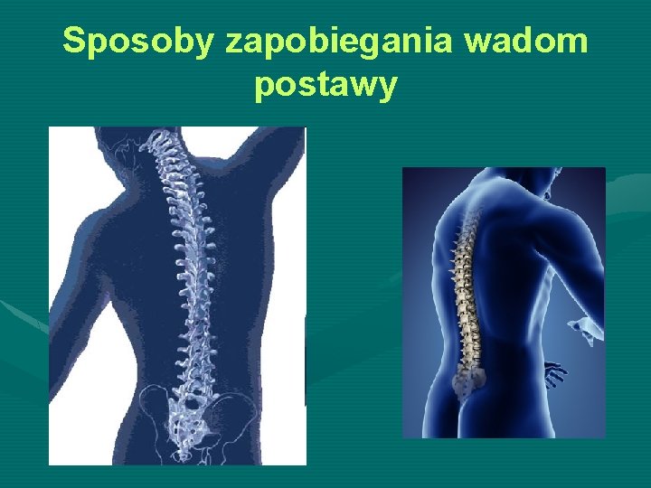 Sposoby zapobiegania wadom postawy 