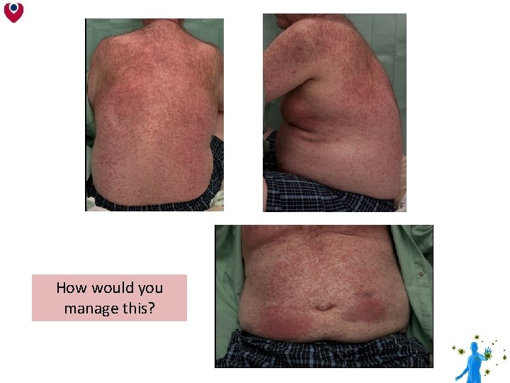 How would you manage this? How would you manage this?