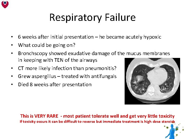 Respiratory Failure • 6 weeks after initial presentation – he became acutely hypoxic • Respiratory Failure • 6 weeks after initial presentation – he became acutely hypoxic •