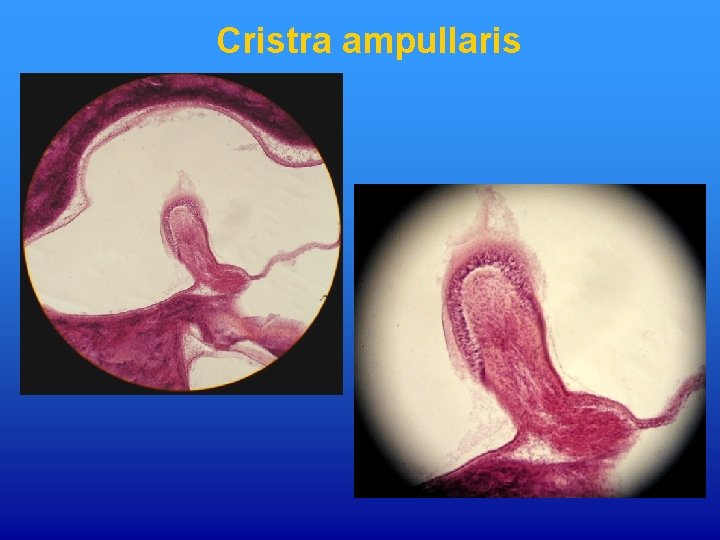 Cristra ampullaris 