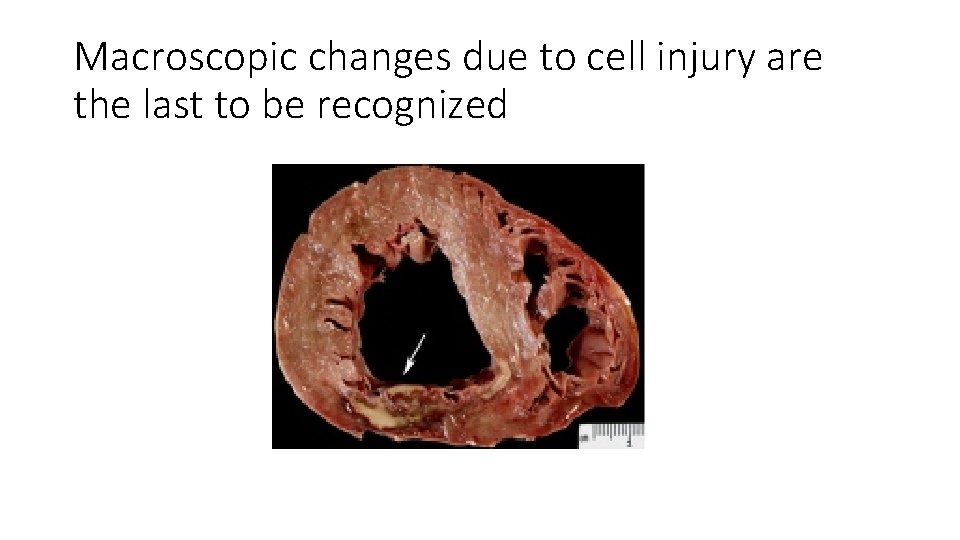 Macroscopic changes due to cell injury are the last to be recognized 