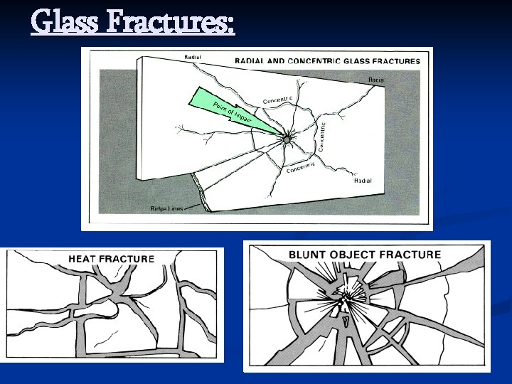 Glass Fractures: 