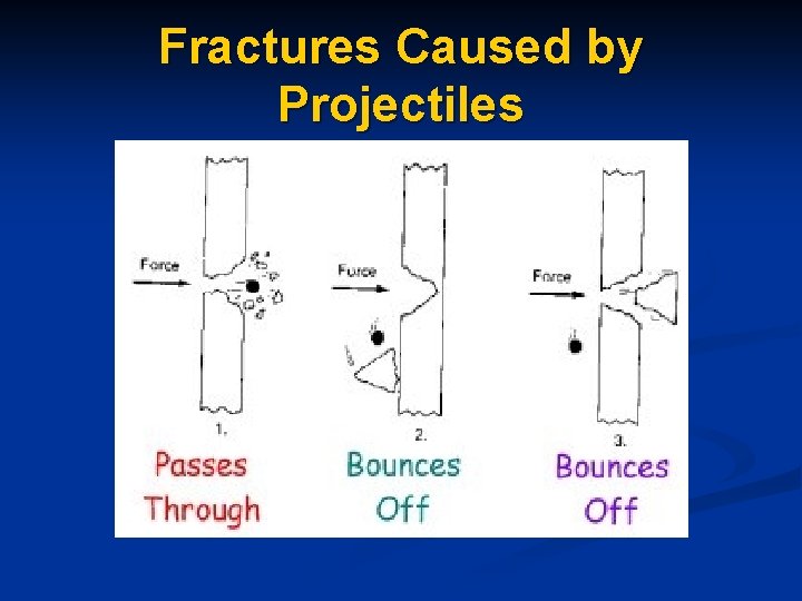 Fractures Caused by Projectiles Fractures Caused by Projectiles