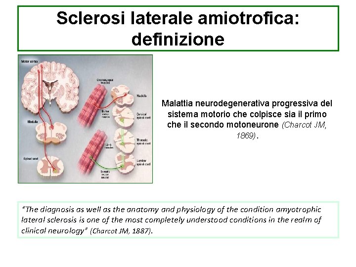 Sclerosi laterale amiotrofica: definizione Malattia neurodegenerativa progressiva del sistema motorio che colpisce sia il