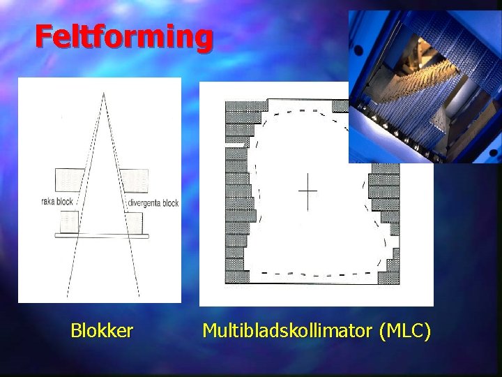 Feltforming Blokker Multibladskollimator (MLC) 