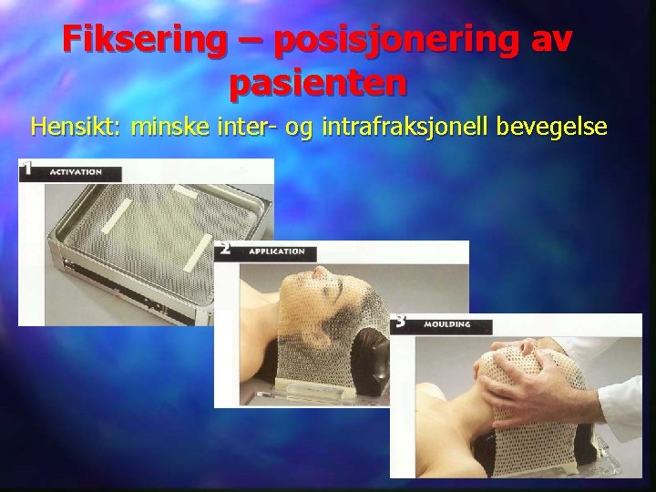 Fiksering – posisjonering av pasienten Hensikt: minske inter- og intrafraksjonell bevegelse 