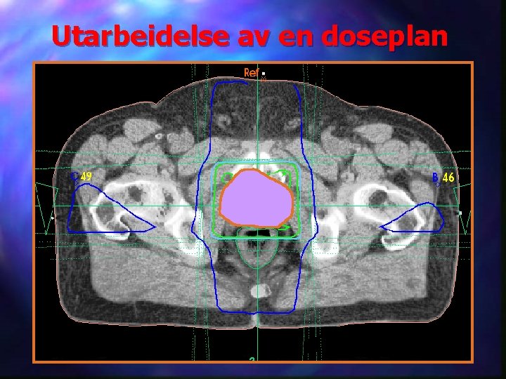 Utarbeidelse av en doseplan 