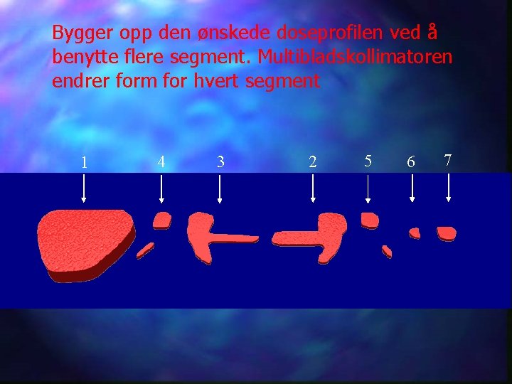 Bygger opp den ønskede doseprofilen ved å benytte flere segment. Multibladskollimatoren endrer form for