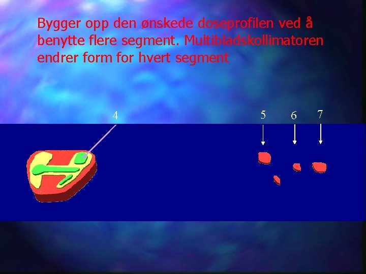 Bygger opp den ønskede doseprofilen ved å benytte flere segment. Multibladskollimatoren endrer form for