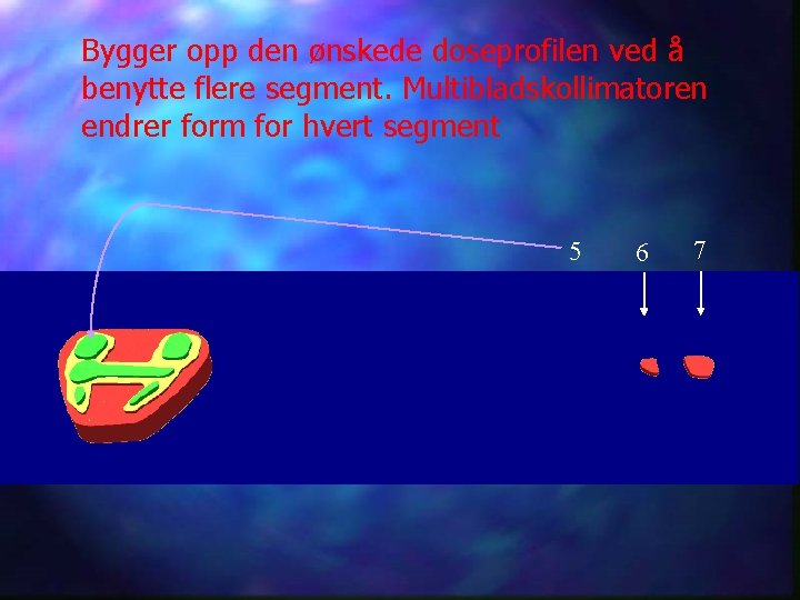 Bygger opp den ønskede doseprofilen ved å benytte flere segment. Multibladskollimatoren endrer form for