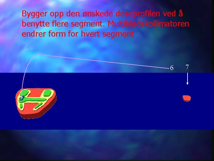Bygger opp den ønskede doseprofilen ved å benytte flere segment. Multibladskollimatoren endrer form for