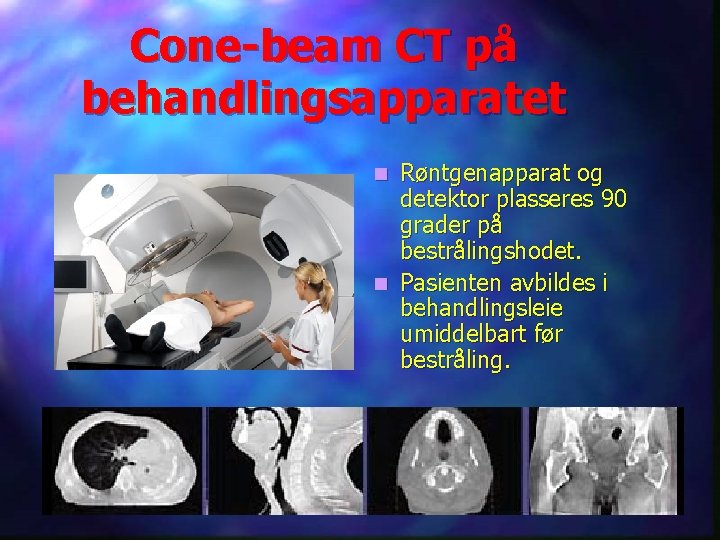 Cone-beam CT på behandlingsapparatet Røntgenapparat og detektor plasseres 90 grader på bestrålingshodet. n Pasienten