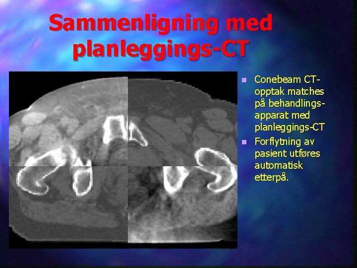 Sammenligning med planleggings-CT Conebeam CTopptak matches på behandlingsapparat med planleggings-CT n Forflytning av pasient
