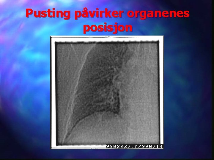 Pusting påvirker organenes posisjon 