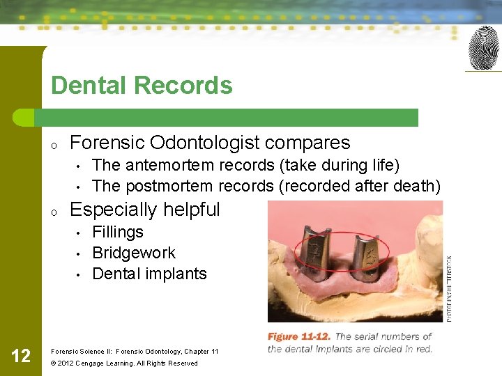 Dental Records o Forensic Odontologist compares • • o Especially helpful • • •