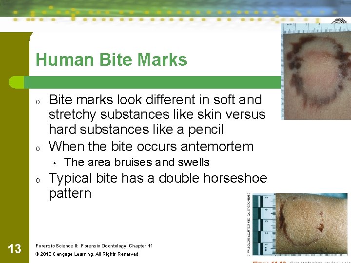 Human Bite Marks o o Bite marks look different in soft and stretchy substances