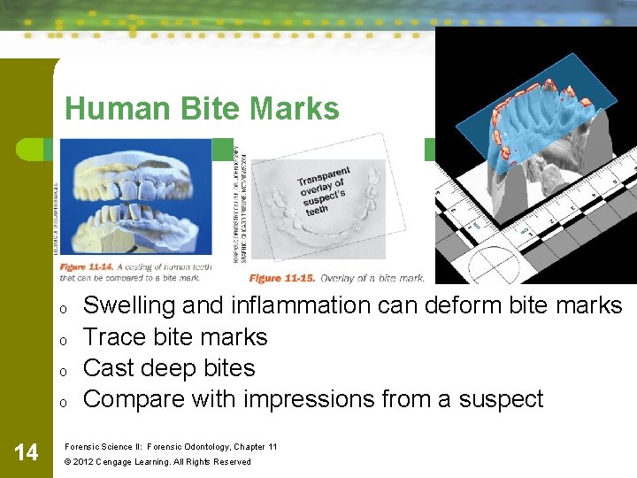 Human Bite Marks o o 14 Swelling and inflammation can deform bite marks Trace