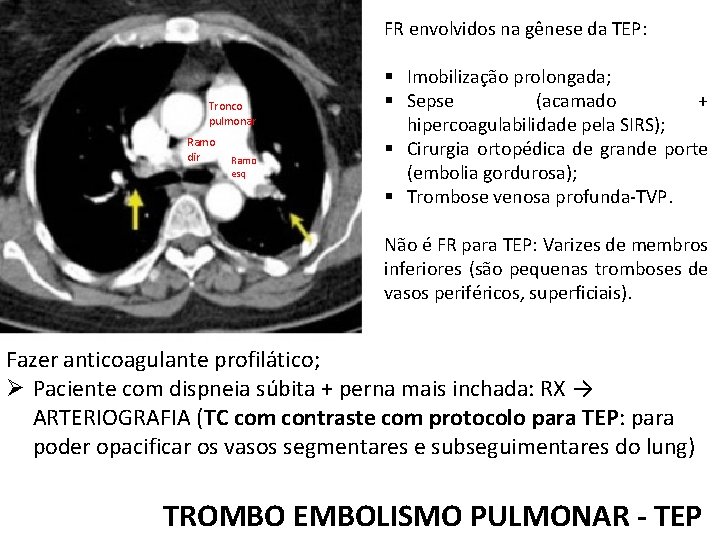 FR envolvidos na gênese da TEP: Tronco pulmonar Ramo dir Ramo esq § Imobilização