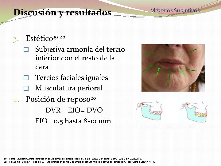 Discusión y resultados Métodos Subjetivos 3. Estético 19 -20 � Subjetiva armonía del tercio