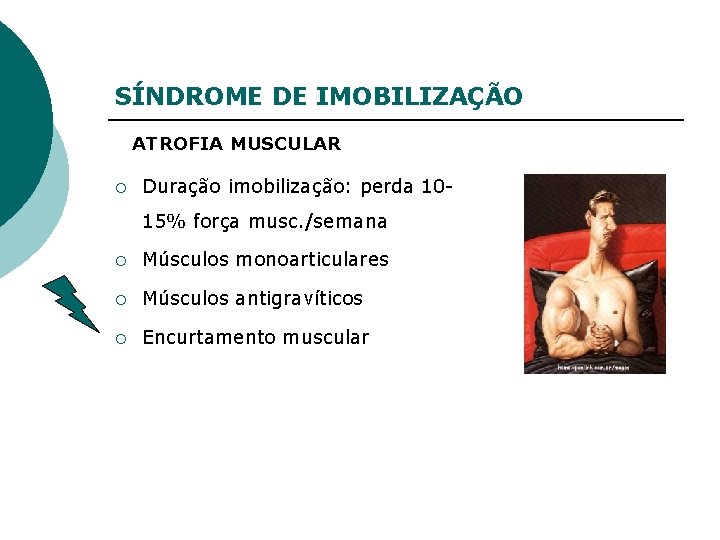 SÍNDROME DE IMOBILIZAÇÃO ATROFIA MUSCULAR ¡ Duração imobilização: perda 1015% força musc. /semana ¡