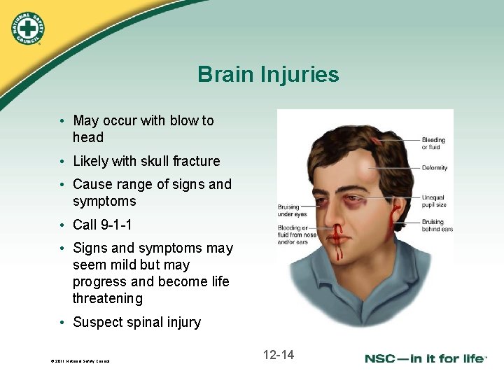 Brain Injuries • May occur with blow to head • Likely with skull fracture