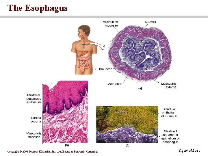 The Esophagus Copyright © 2004 Pearson Education, Inc. , publishing as Benjamin Cummings Figure